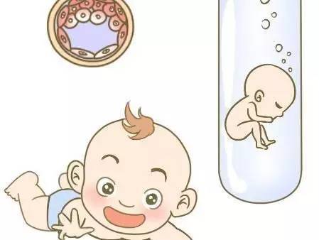 专家